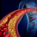 Understanding the Link Between Your Blood Type and Health